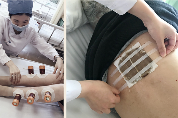 好色tv
肿瘤中医重点专科汇报材料-44.jpg