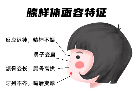 腺样体面容.jpg 腺样体面容.jpg